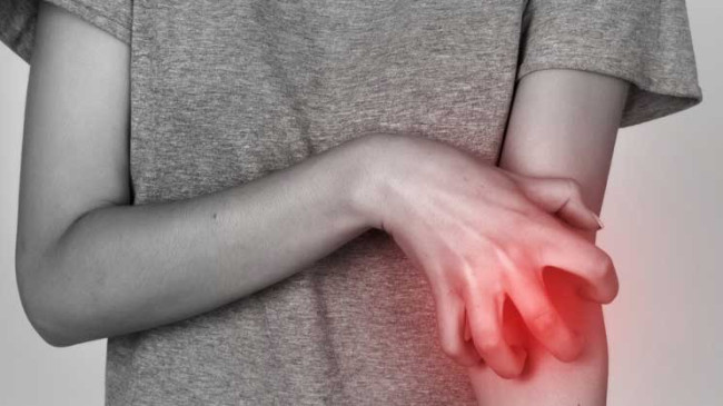 Uyuz Hastalığı Tedavisi ve Faydalı Bilgiler